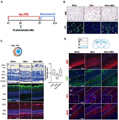 Therapeutic Effects of Mesenchymal Stromal Cell-Derived Small Extracellular Vesicles in Oxygen-Induced Multi-Organ Disease: A Developmental Perspective